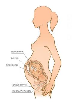 беременность 34 недели