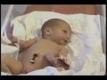 Первые дни жизни новорожденных